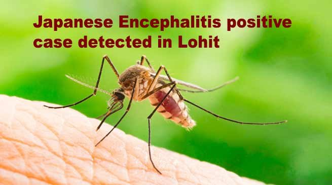 Arunachal: Japanese Encephalitis positive case detected in Lohit