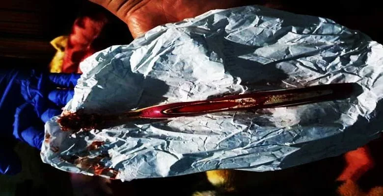 Arunachal: Doctor removes toothbrush from man's stomach