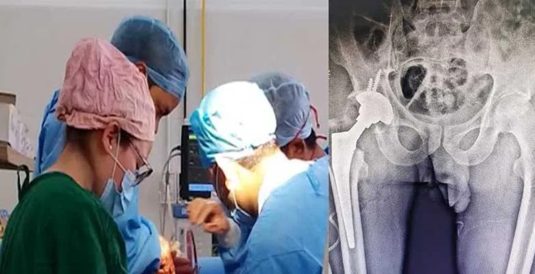 Arunachal: Total Hip Replacement Surgery done at Tawang dist Hospital