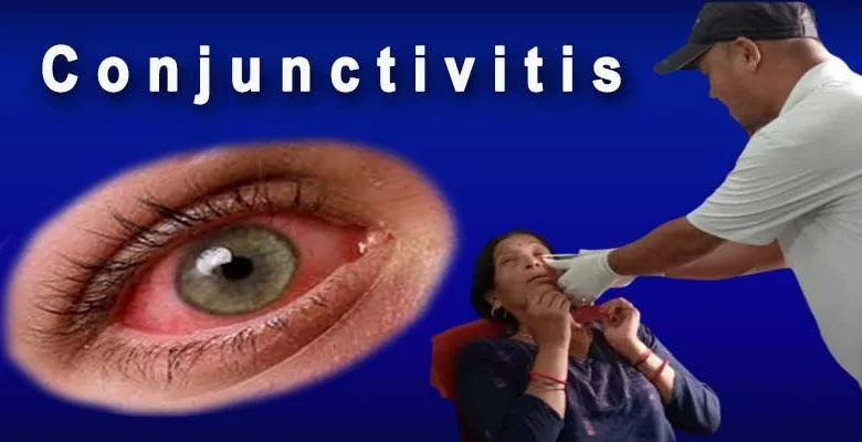 Arunachal: Conjunctivitis now spreading from children to adults