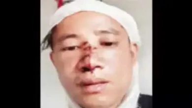 Sikkim Man Called 'Chinese', and Brutally beaten by Miscreants In Bengaluru