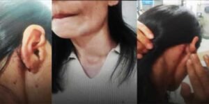 Delhi Park Assault on Northeast Women Sparks Outrage