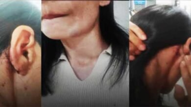 Delhi Park Assault on Northeast Women Sparks Outrage