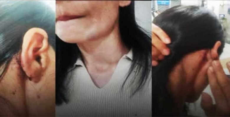 Delhi Park Assault on Northeast Women Sparks Outrage